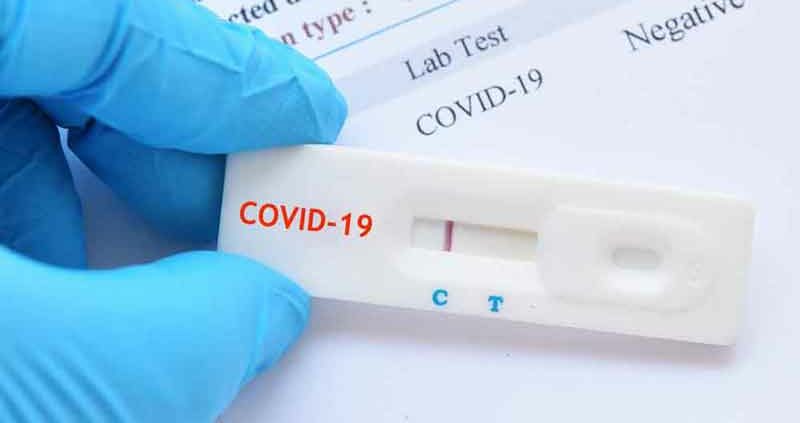 Corona-Schnelltest für Arbeitgeber Pflicht